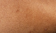closeup human skin