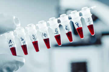 Poster - pcr strip and biological microscope