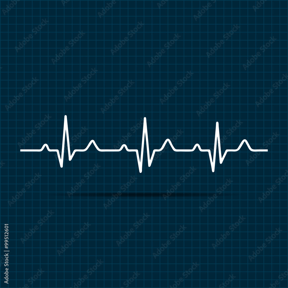 Vector Illustration heart rhythm ekg . Stock Vector | Adobe Stock