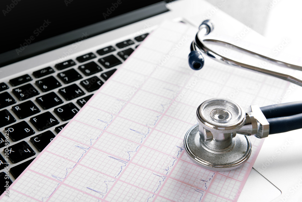 Stethoscope on cardiogram  sheet, closeup