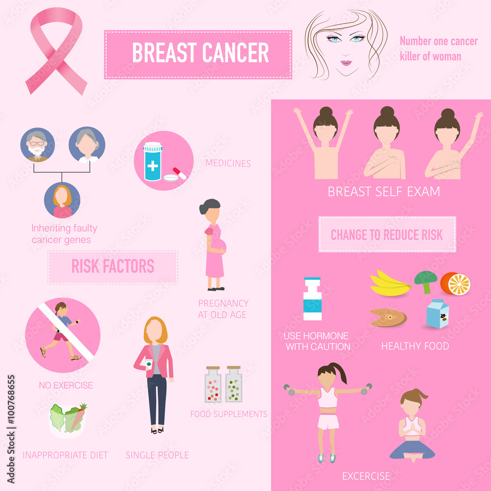 breast cancer risks and change to reduce infographics illustrati Stock ...