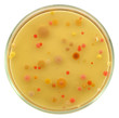 Different color, size and type colonies of bacteria from public premises air on a petri dish (agar plate) isolated on white background by pen tool. 