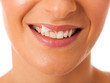 © Samo Trebizan - Clean healthy white teeth of smiling happy woman.