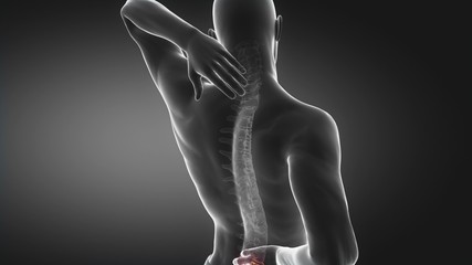 Sticker - Pain in spine proceed to neck region