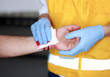 © systemedic - Fake bloody hand first aid paramedic