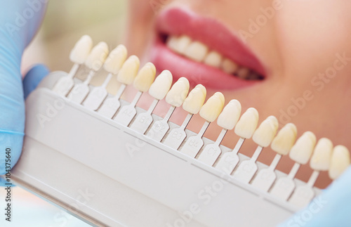 Fotografía Hermosa mujer europea sonrisa con dientes sanos blanqueamiento