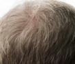 Graues und lichtes Haar als Closeup mit beginnendem Haarausfall