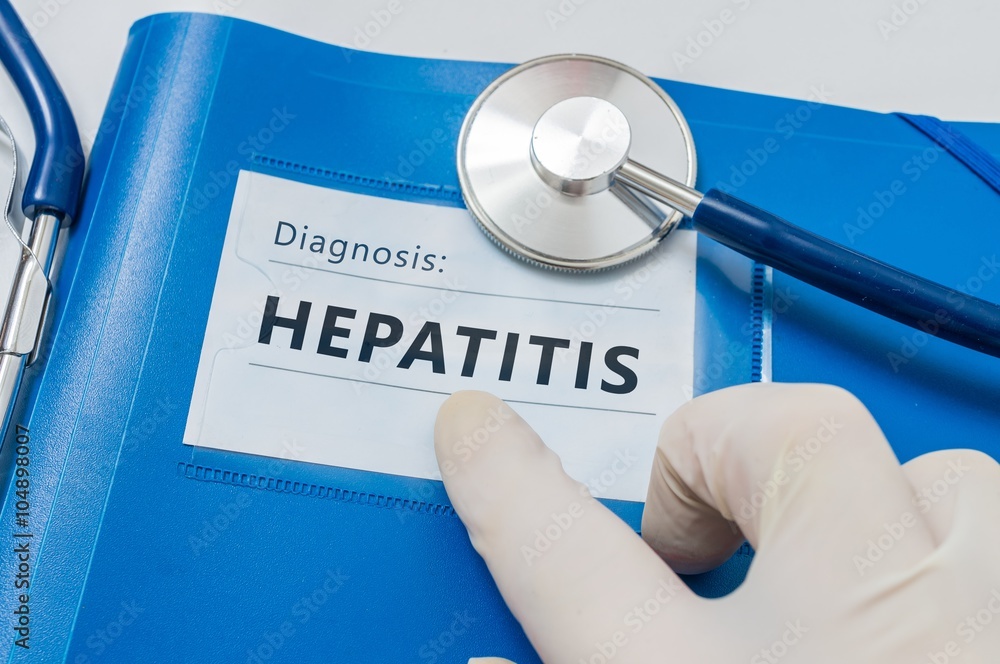 Blue folder with Hepatitis C diagnosis. - obrazy, fototapety, plakaty 