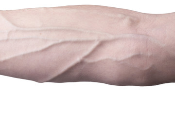 Veins on an arm