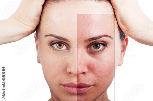 Fotografie, Obraz Flawless woman portrait before and after facial correction