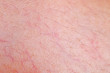 Skin texture with capillary for pattern