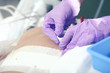 Bandaging patient's postoperative wound