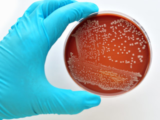 Colonies of bacteria in culture medium plate
