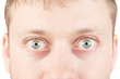 © alexugalek - Man's surprised eyes isolated on white