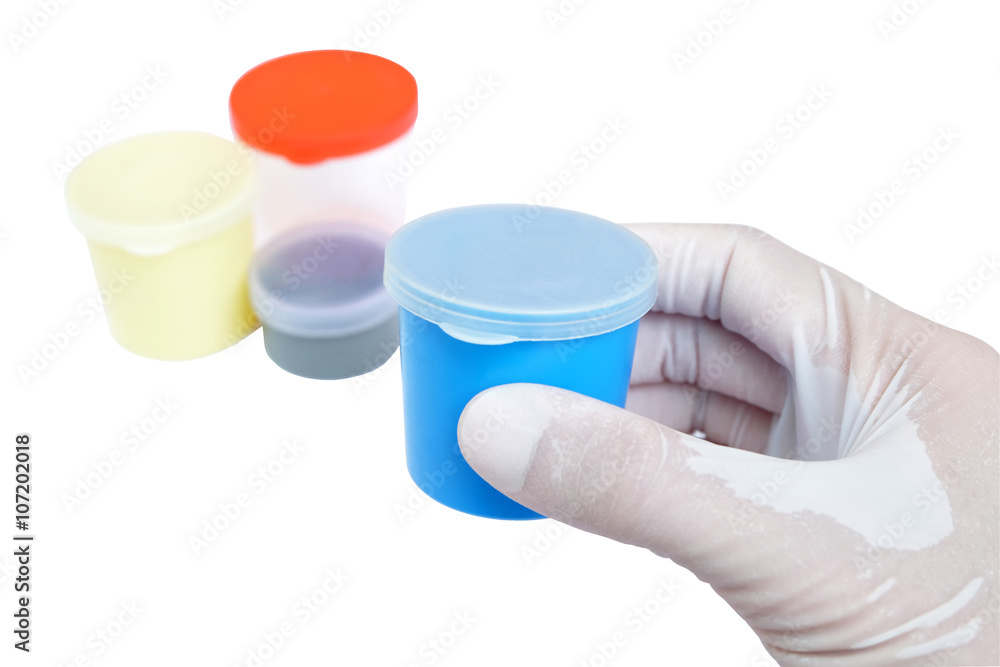 blue urine container held by hand with other urine and sputum Stock ...