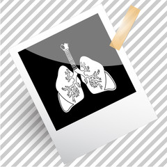 Canvas Print - lungs.