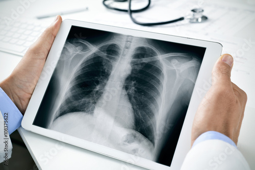 Fotografie, Obraz doctor observing a chest radiograph in a tablet