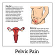 © sabelskaya - Concept illustration of a womans pain in stomach, menstrual cramps, diarrhea, indigestion, girl holding hands on a sick stomach, vector sketch art on a white background with a red area of pain