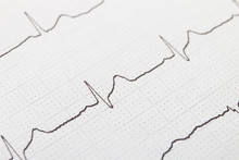 Close Up Of Electrocardiogram Chart Background