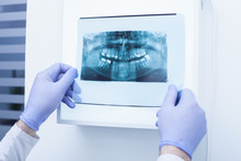 Male Doctor Holding And Looking At Dental X-ray