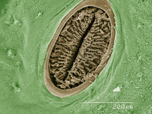 Coloured SEM Of Spiracle Of Hornworm (Sphingidae)
