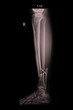 © jarvaj - fracture left leg tibia and fibula