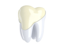 Restoration And Renovation Of The Tooth Enamel. 3D Render