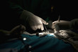 © fStop - A surgery team operating on a patient in an operating room, focus on hands