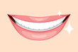 Beautiful Mouth, Smile And Teeth, Medical, Dentistry, Hospital, Checkup, Patient, Hygiene, Healthy, Treatment
