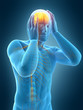 © Sebastian Kaulitzki - medically accurate 3d illustration of headache/ migraine