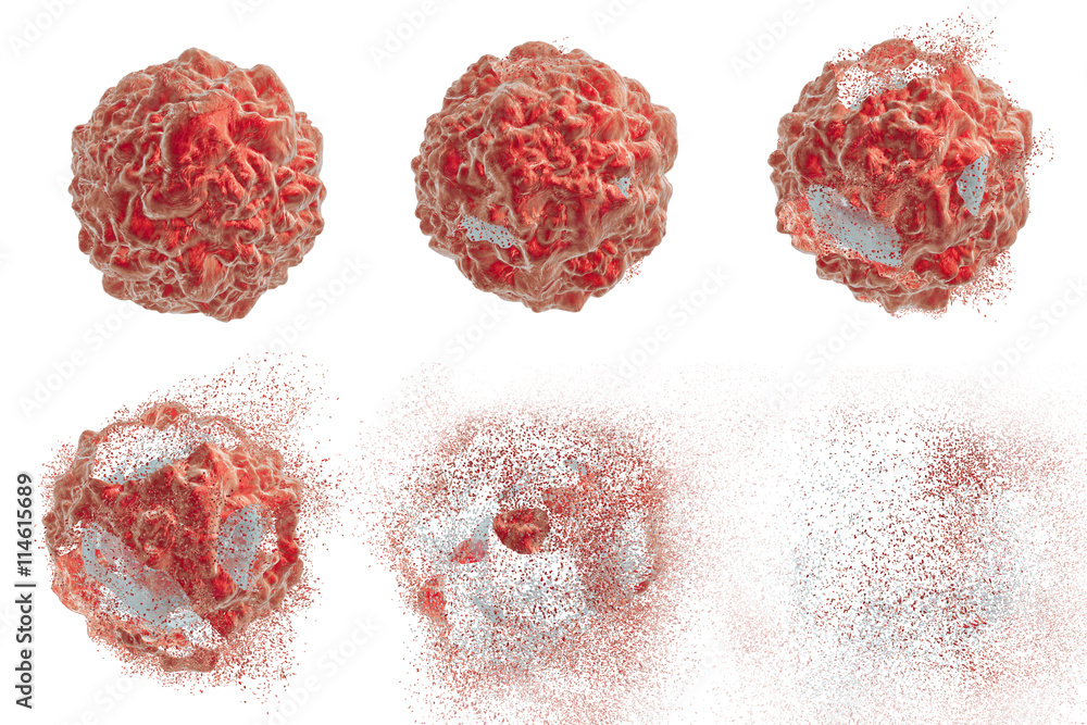 Destruction of a tumor cell. 3D illustration. Series of images showing different stages of destruction of a tumor cell. Can be used to illustrate effect of drugs, medicines, microbes, nanoparticles - obrazy, fototapety, plakaty 