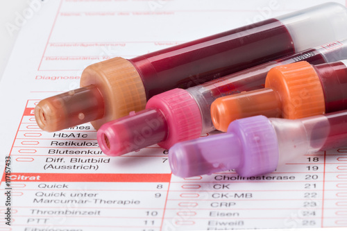 Blutuntersuchung, Blutproben auf einem Laborformular – kaufen Sie ...