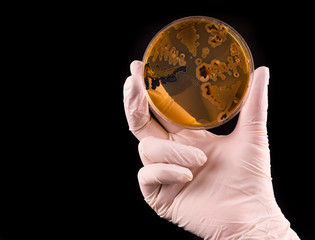 Wall Mural - Scientist's hand holding petri dish infected with Salmonella bacteria on black background