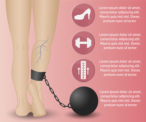 varicose Infographics phlebology