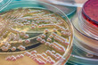 Bacterial colonies culture on MacConkey agar