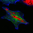 Real fluorescence microscopic view of human neuroblastoma cells