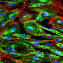 Confocal Microscopy Of Fibroblast Cells