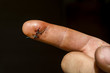 © gubernat - Surgical suture on the finger.