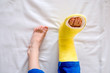 © Halfpoint - Broken leg in cast of unrecognizable little boy.