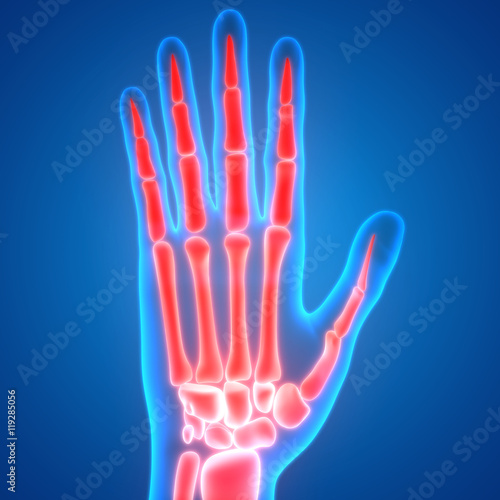 Human Body Bone Joint Pains (Finger Joints) Anatomy Stock Illustration
