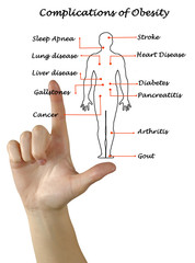 Poster - Complications of Obesity