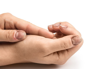 Female hands with dirty nails