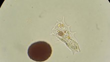 Unicellular Amoeba Motion Under Microscope 600x