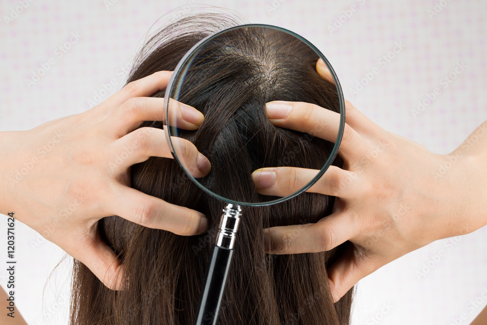 虫めがね / 頭皮ケア