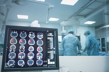 surgery on the brain under x-ray monitoring