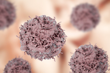 Poster - Lung cancer cells on colorful background, 3D illustration