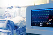 Monitoring of patient's heart in intensive care unit