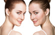 Girl with acne before and after treatment