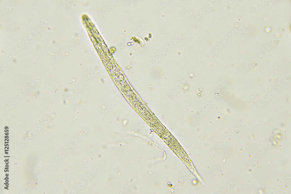 Strongyloides stercoralis (threadworm) in stool, analyze by microscope ...