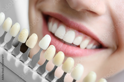 Fotomural Young woman choosing color of teeth at dentist, closeup